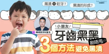 牙齒有黑漬 兒童牙科收費