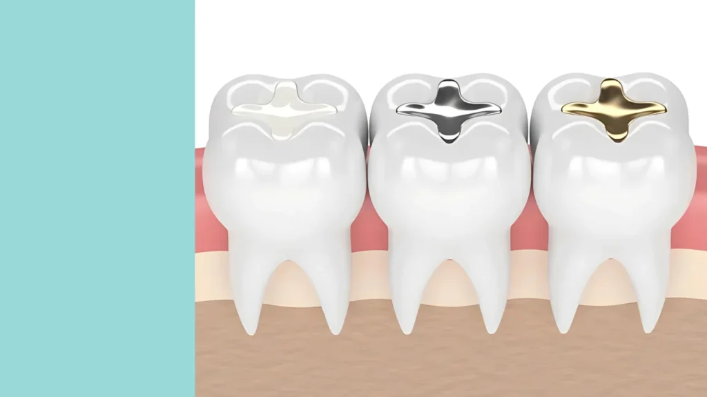 補牙 tsuen Wan Dentist