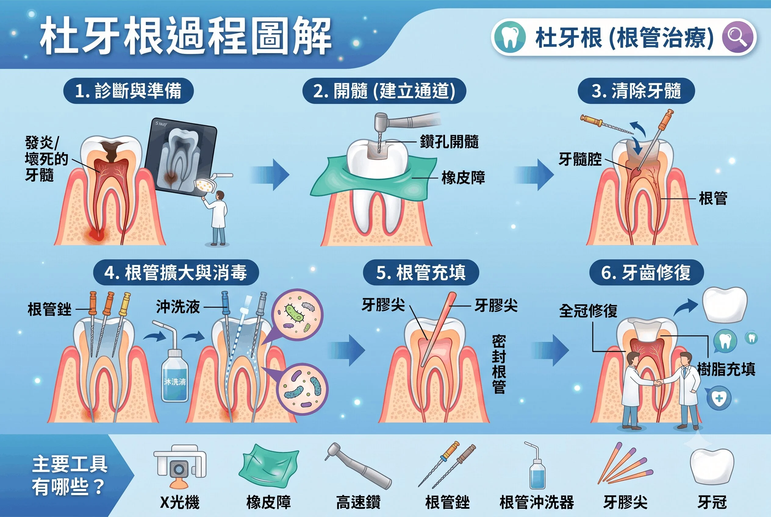 杜牙根流程