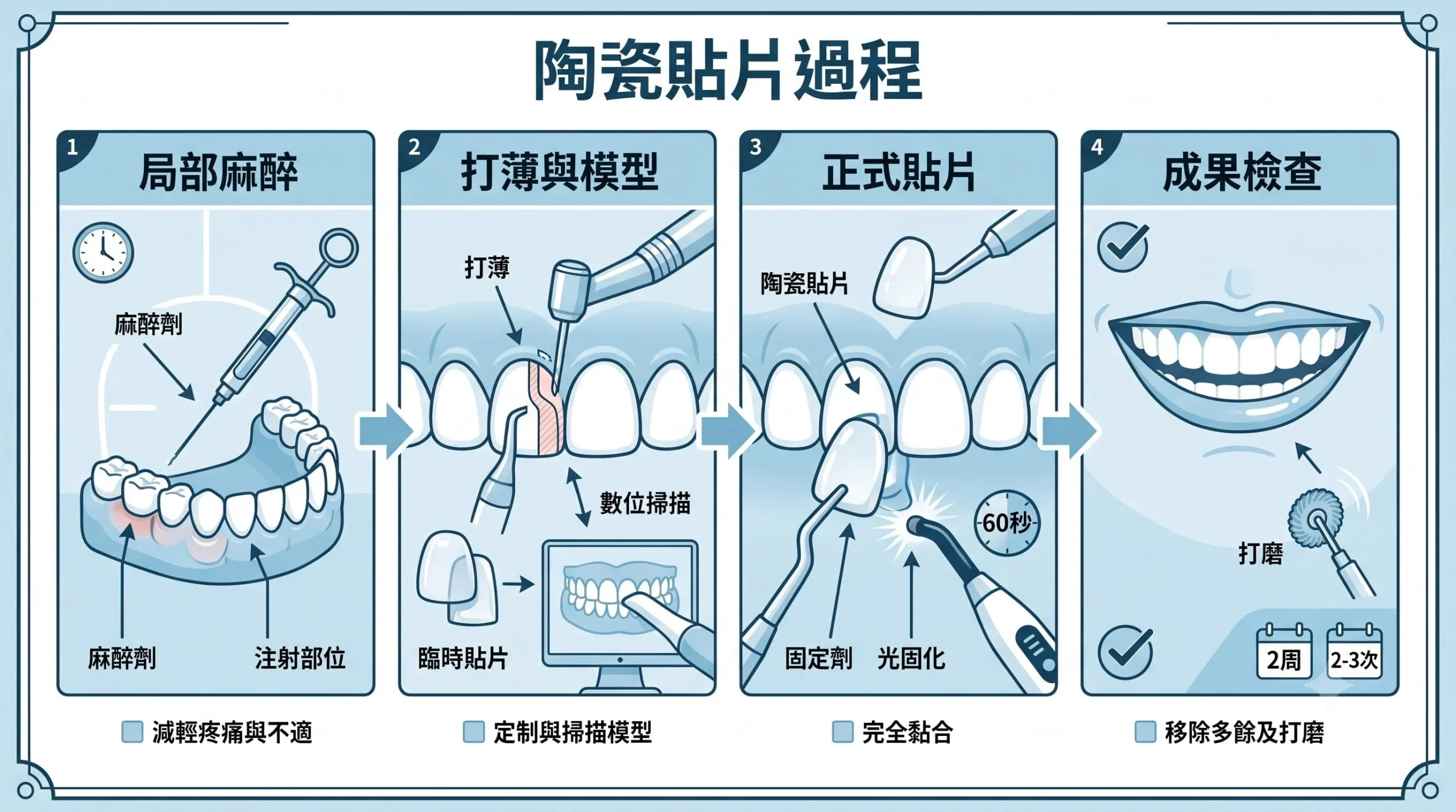 陶瓷貼片牙醫過程步驟 Dr Eric Chan